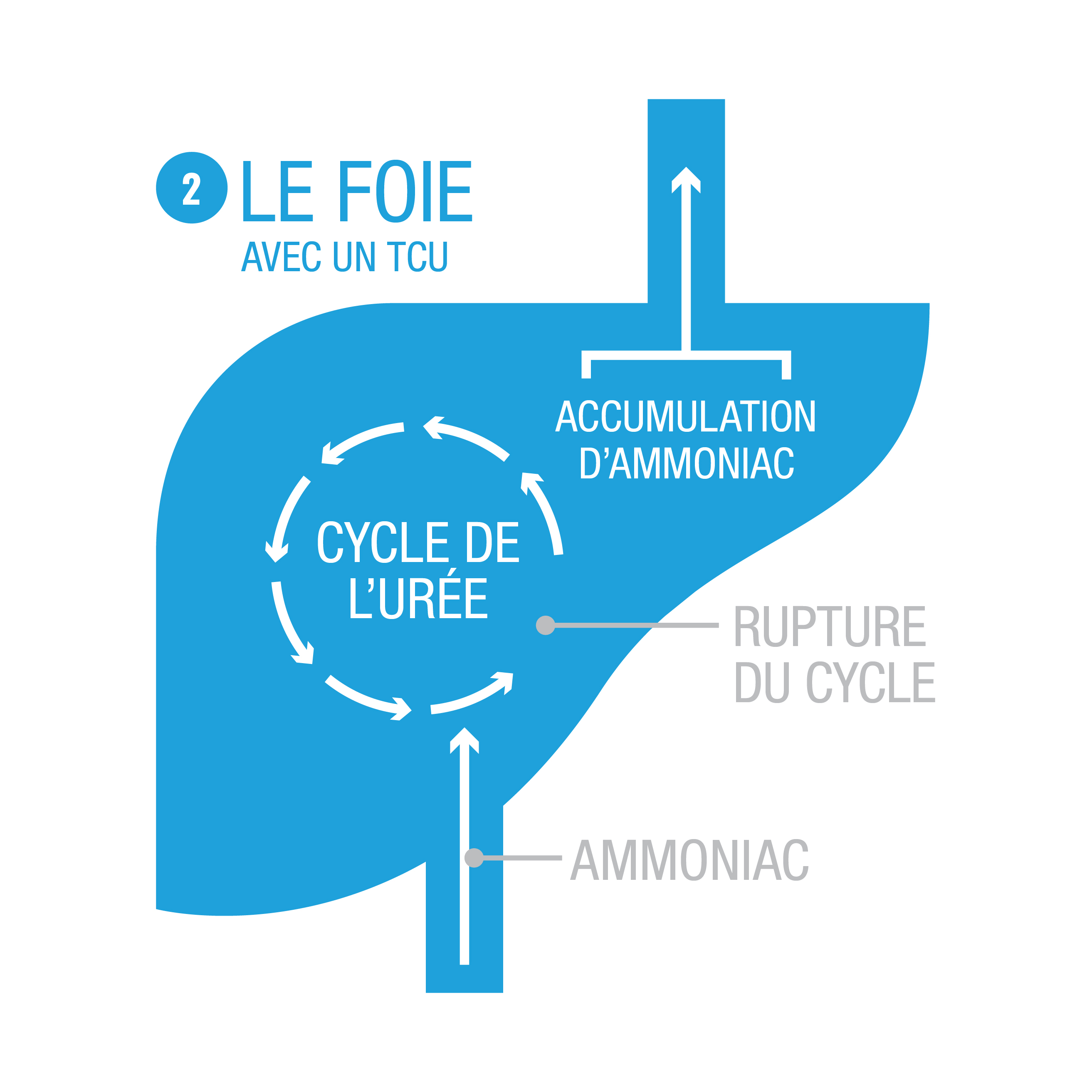 Urea Cycle Disorder diagram showing how break in cycle causes high ammonia levels